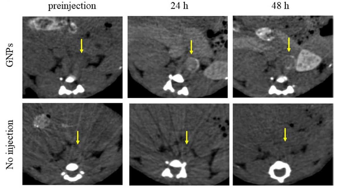 Biomedical Detection